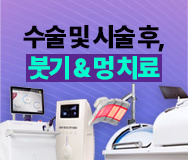 수술 및 시술 후, 붓기 & 멍치료 배너