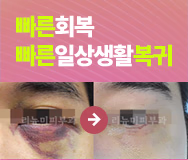 빠른 회복! 빠른 일상생활 복귀! 고압산소치료 배너