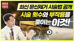 문신제거 레이저 종류별 효과! 한번에 보기! + 최신 시술법 | 전후모음 | 부작용 주의사항
